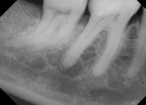 Endodontist 07601